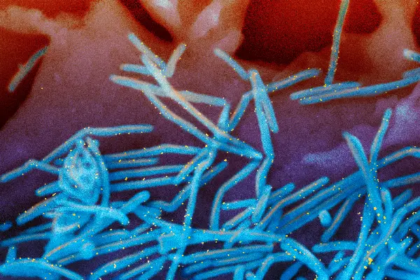 US Experiences Mild Flu Season So Far, But Experts Warn of Potential Surge